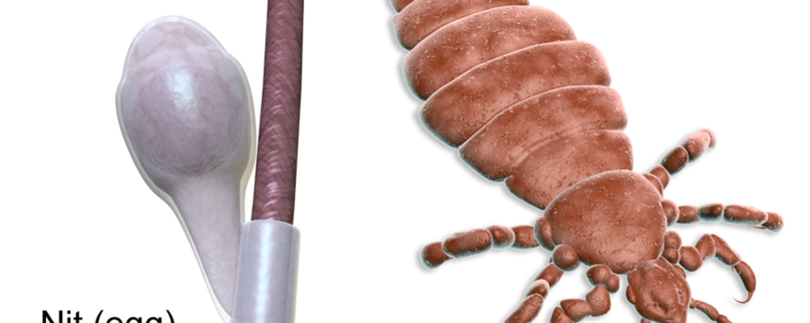 The Science of Head Lice