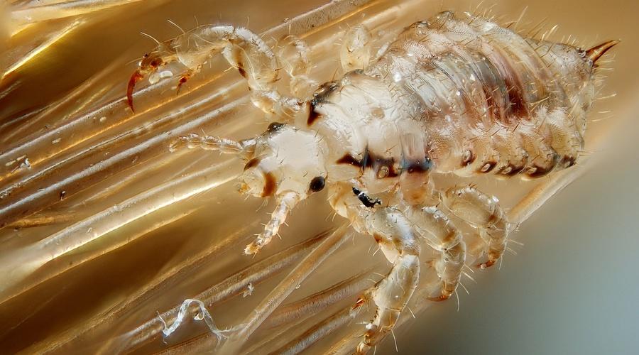 Head lice on 2025 shoulders